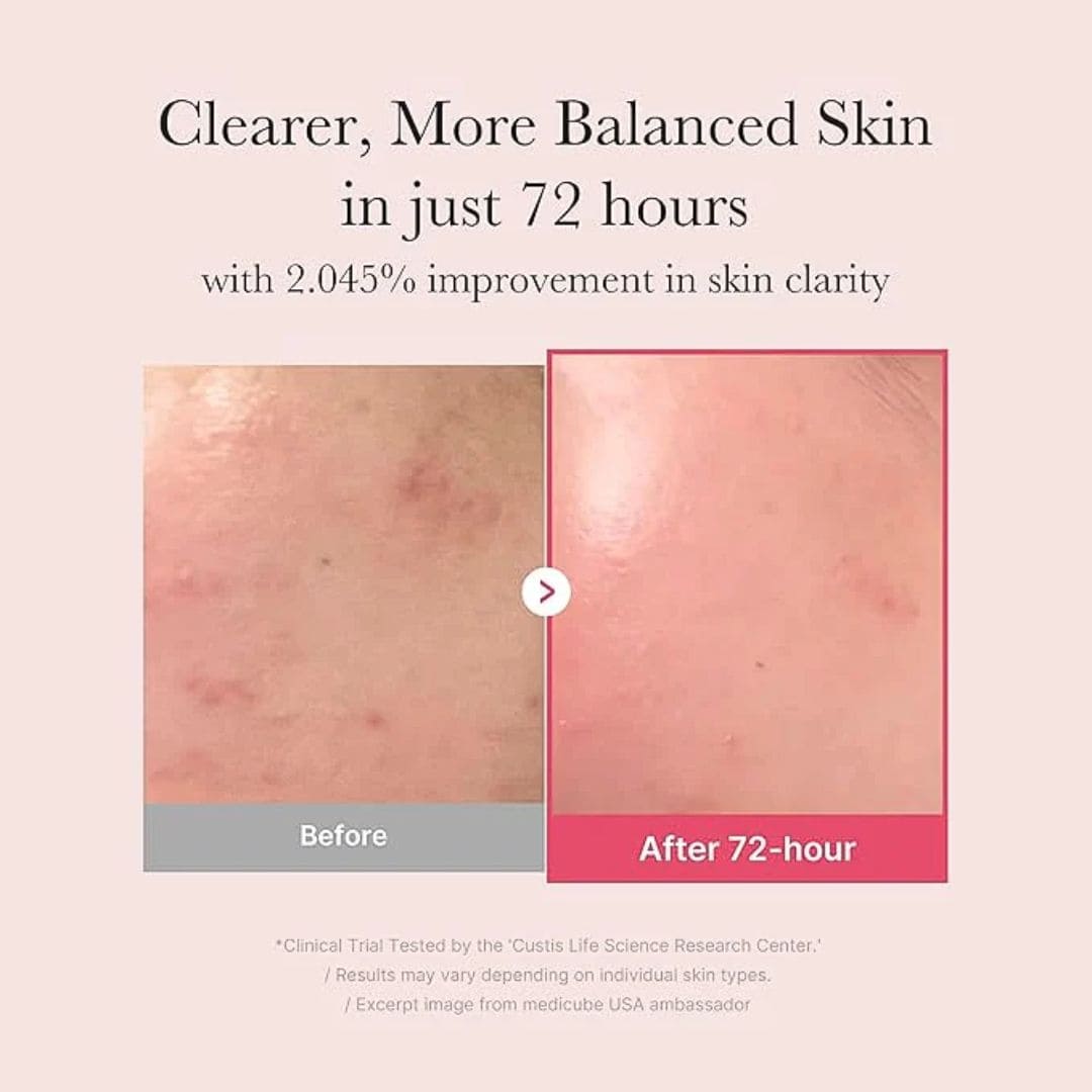 Medicube TXA Niacinamide 15 Serum 30ml before & after