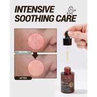 Acwell Licorice pH Balancing Advance Serum - AuraSilque
